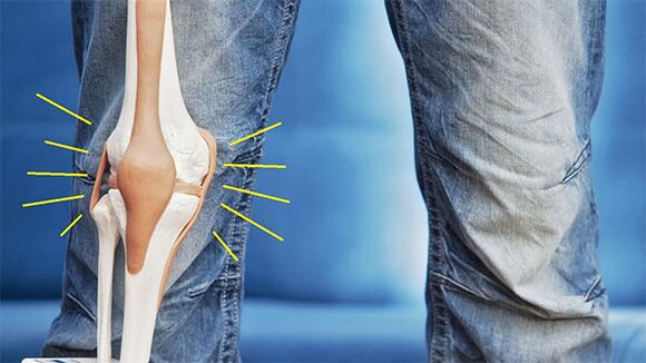 fájdalom a térdízületben