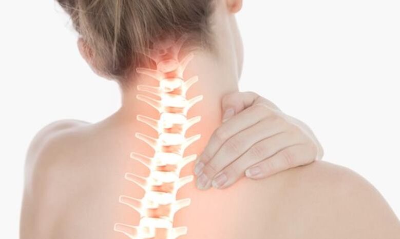a nyaki gerinc osteochondrosisát