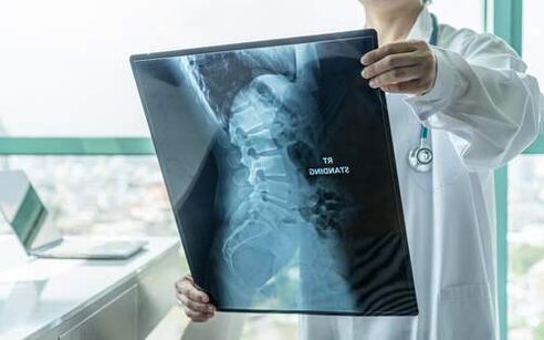 A röntgen szükséges diagnosztikai módszer, ha fáj a hát